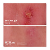 Cicaplast Baume B5+ Ultra Repairing Soothing Balm