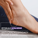 Epitheliale Ultra Repair Balm Patch