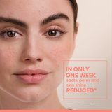 Cleanance Comedomed+ Anti-Blemish treatment