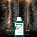 Anti-dandruff Treatment and Rebalancing Shampoo