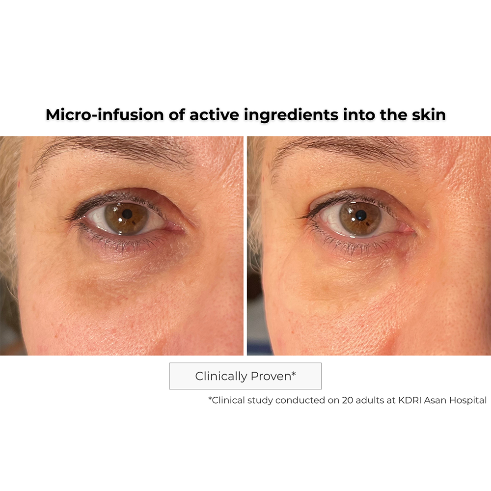 Microneedling Eye Contour Patch