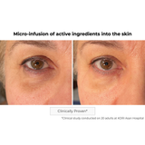 Microneedling Eye Contour Patch