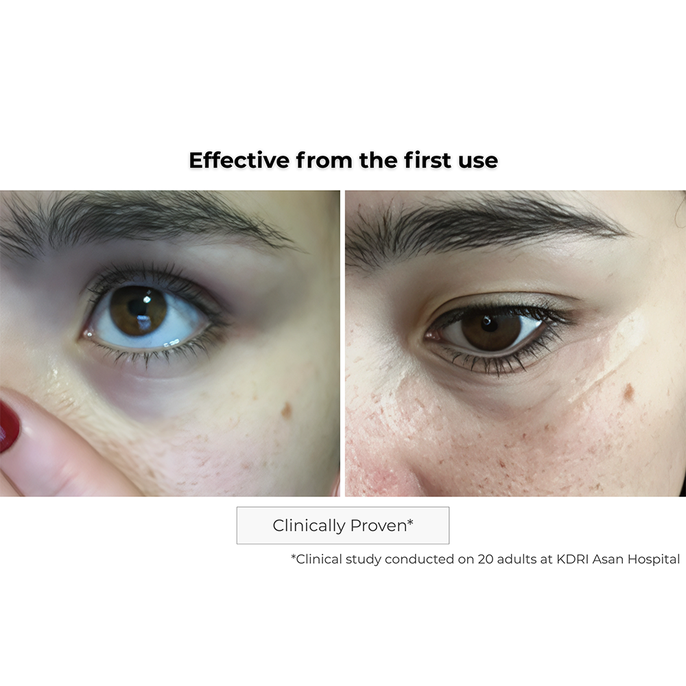 Microneedling Eye Contour Patch