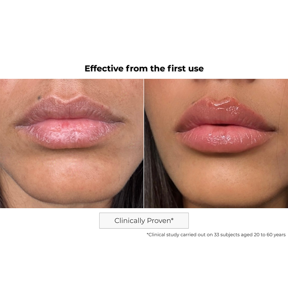 Microneedling Lips Patch