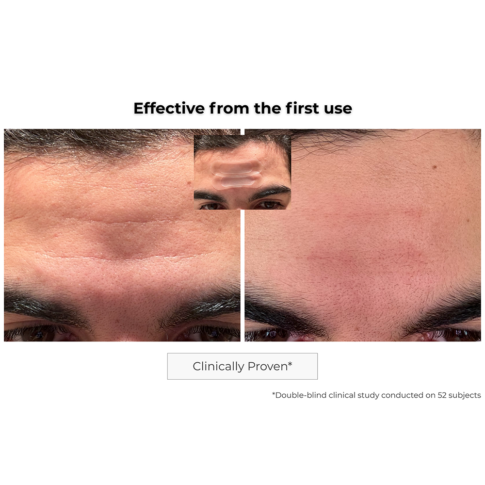 Microneedling Anti-Aging Patch