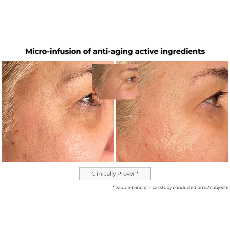 Microneedling Anti-Aging Patch