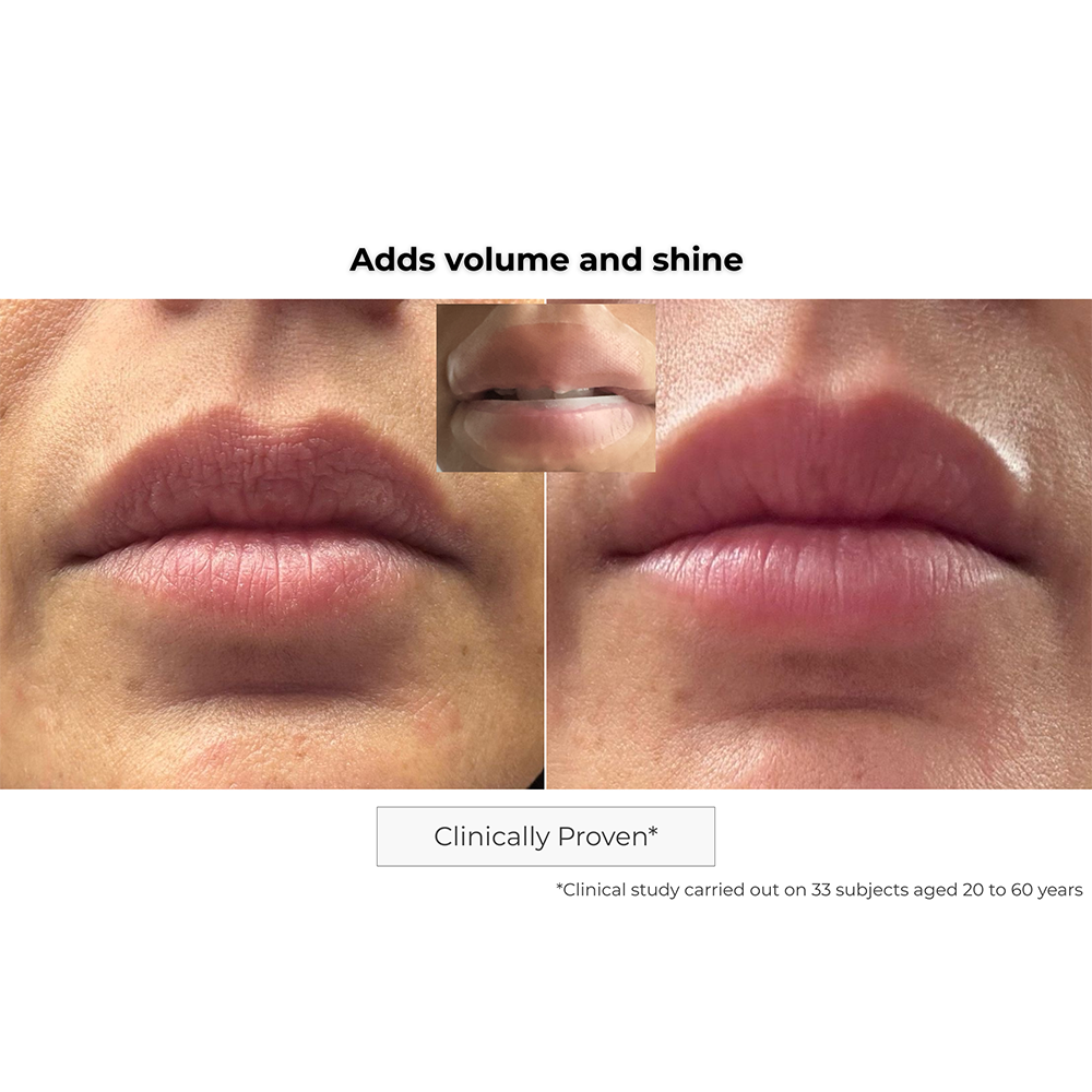 Microneedling Lips Patch
