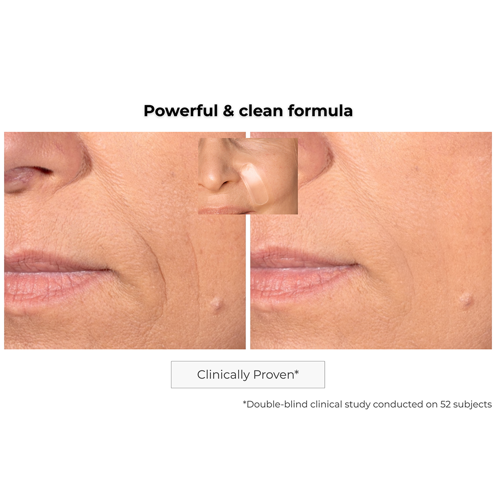 Microneedling Anti-Aging Patch