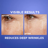 Revitalift Retinol Serum