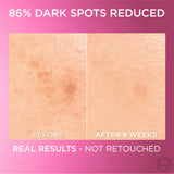 Glycolic Bright Serum with 8% [Melasyl ™ + Glycolic Acid + Niacinamide]